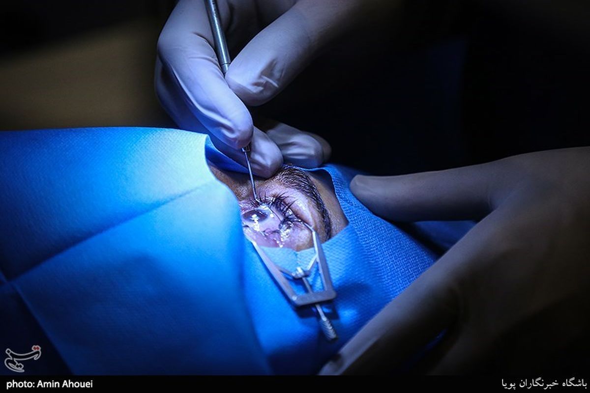 اولین پیوند سلول بنیادی قرنیه در مراکز درمانی نیروهای مسلح