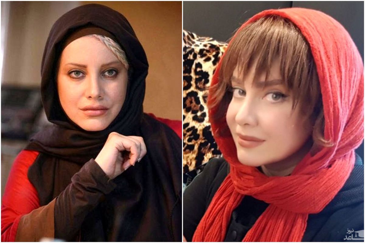 نظر شراره رخام در مورد جراحی زیبایی