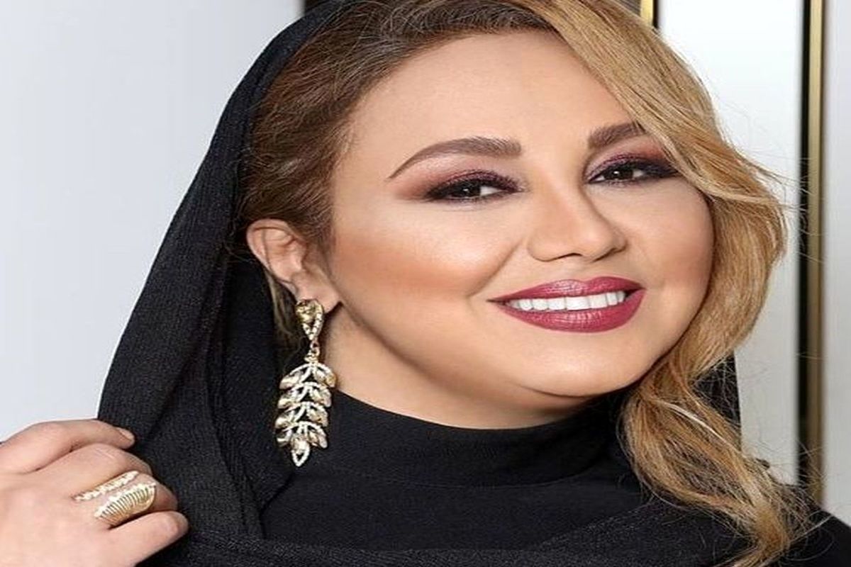 تغییرفاحش این سلبریتی سوژه شد