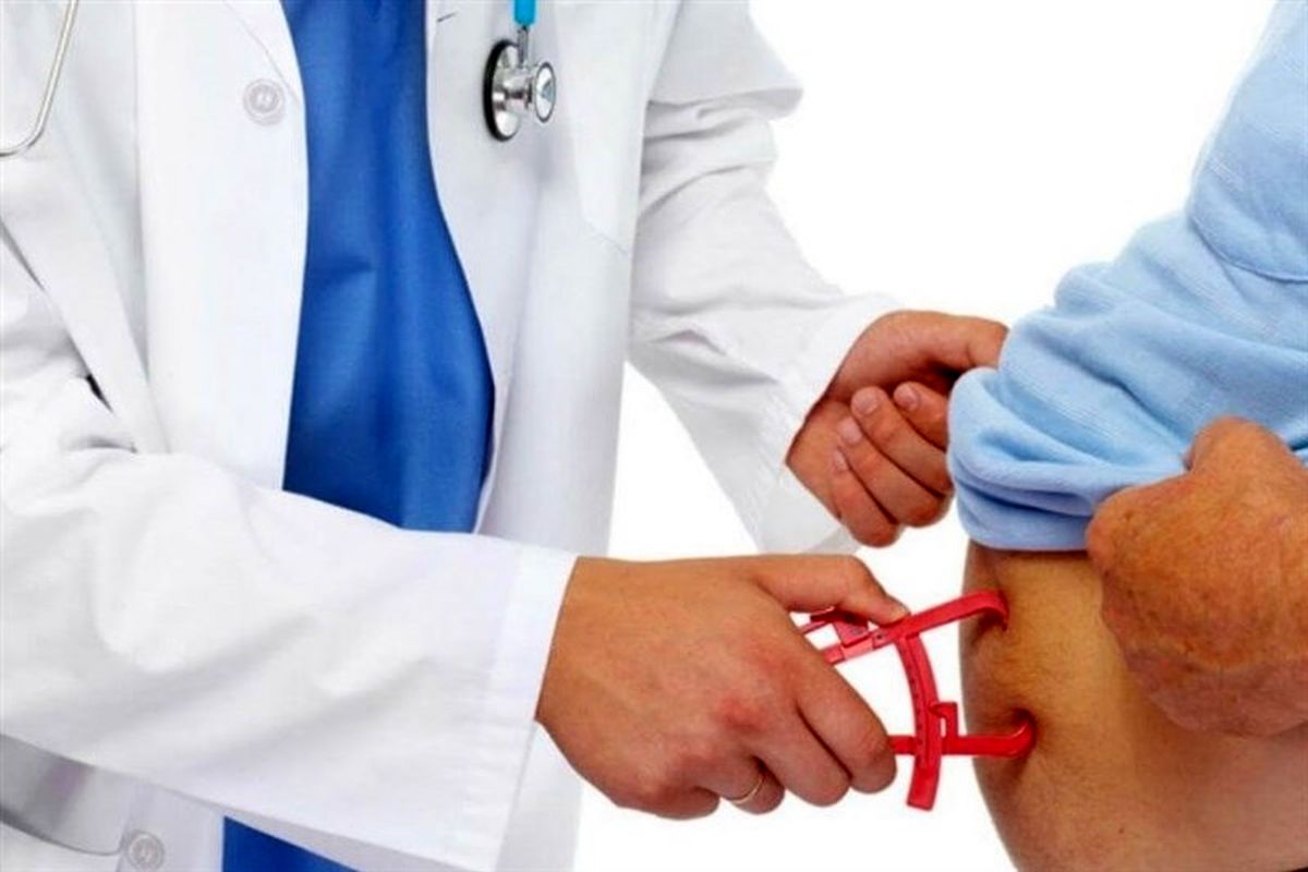 چاره چاقی چیست؟