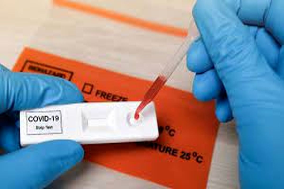 چند روز بعد علایم کرونا تست بدهیم؟