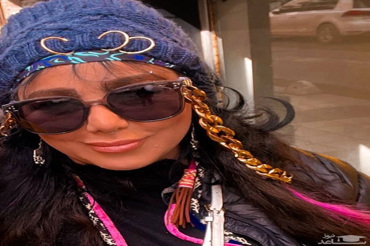 تغییر فرم صورت ناجور بهنوش بختیاری!