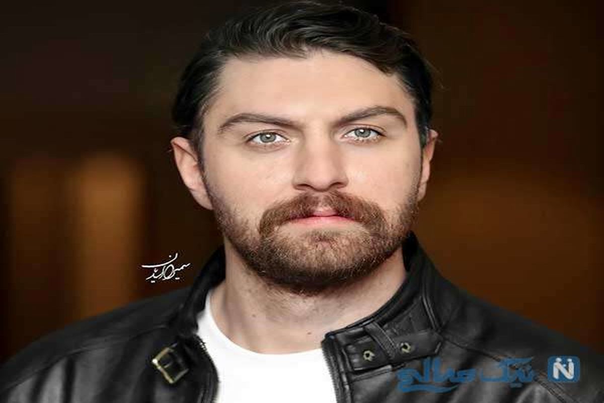 آسیب شدید آقای هنرپیشه + عکس