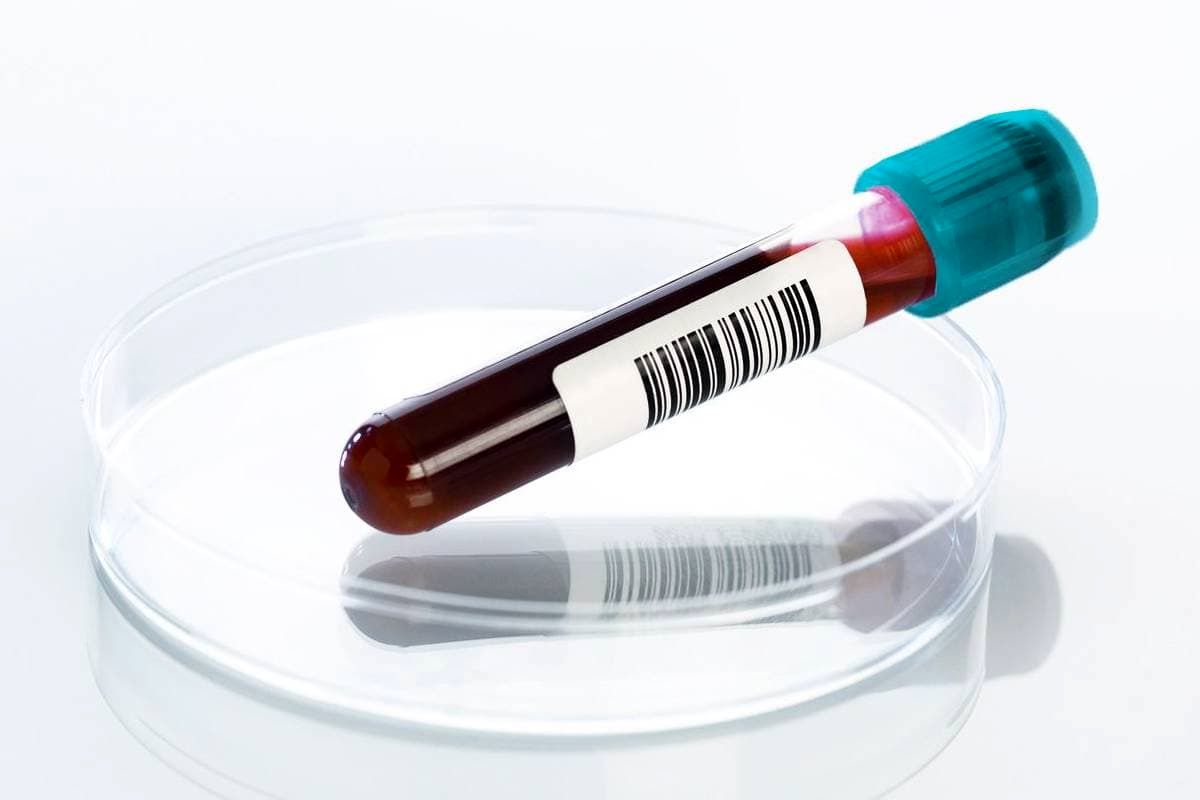 این آزمایش خون، آلزایمر آینده شما را لو می دهد