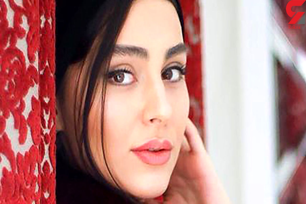 عکسی از لاله مرزبان با صورت پر از کک و مک