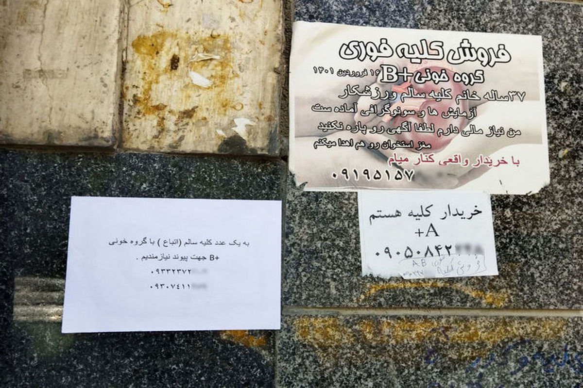 اسکناس هایی که بوی خون می‌دهد / فروش اعضای بدن کسب و کار جدید فقرای آبرومند!