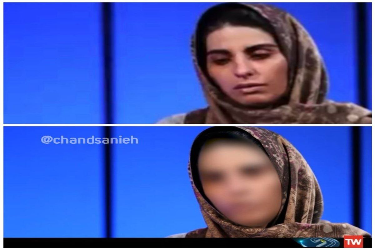 چهره سپیده رشنو برای اولین بار پس از مصاحبه