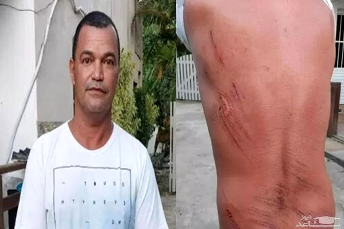 مرد برزیلی با لیمو از مرگ نجات یافت!