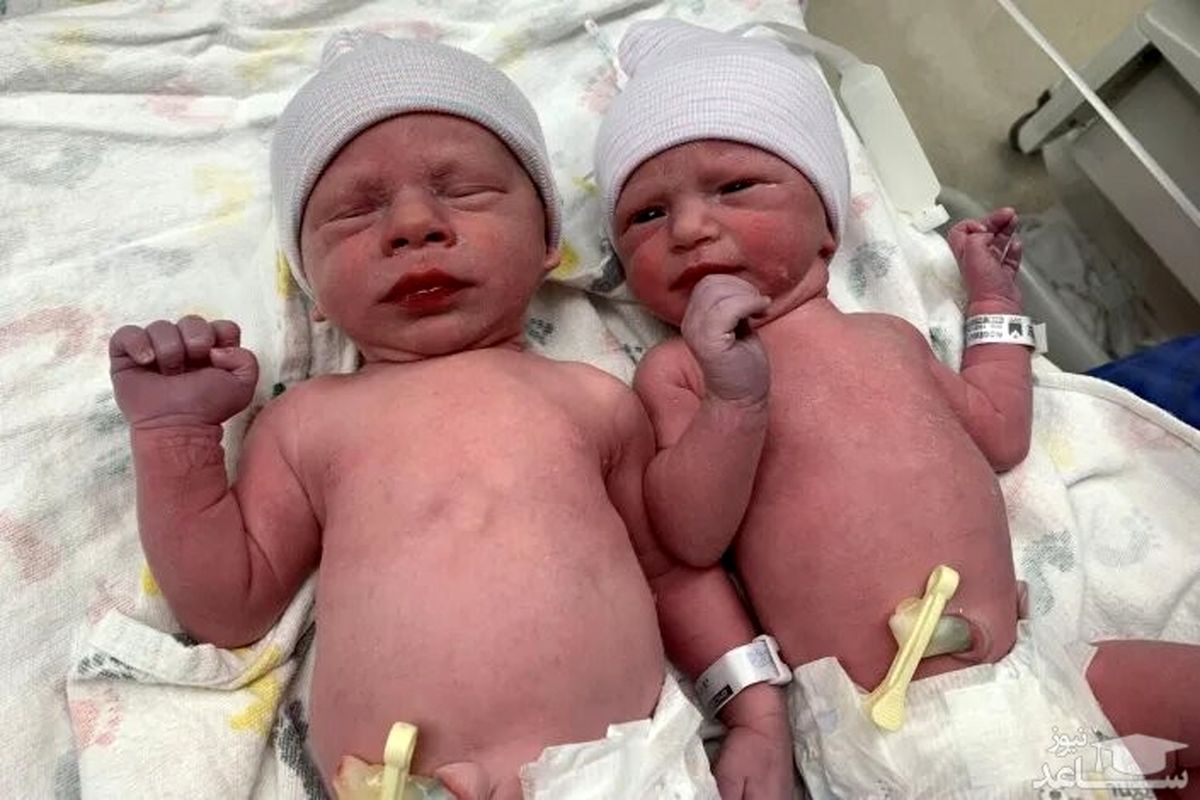 دوقلوهایی که باید ۳۰سال پیش به دنیا می آمدند