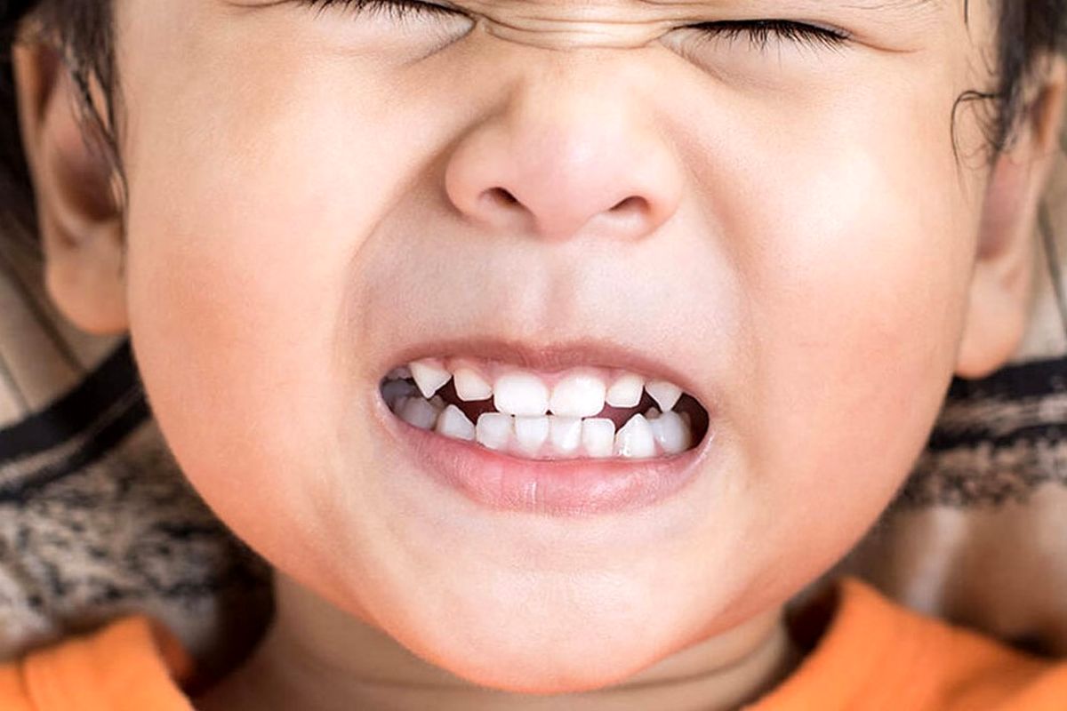 راهکارهای جدید برای کاهش دردهای ناشی از دندان‌قروچه