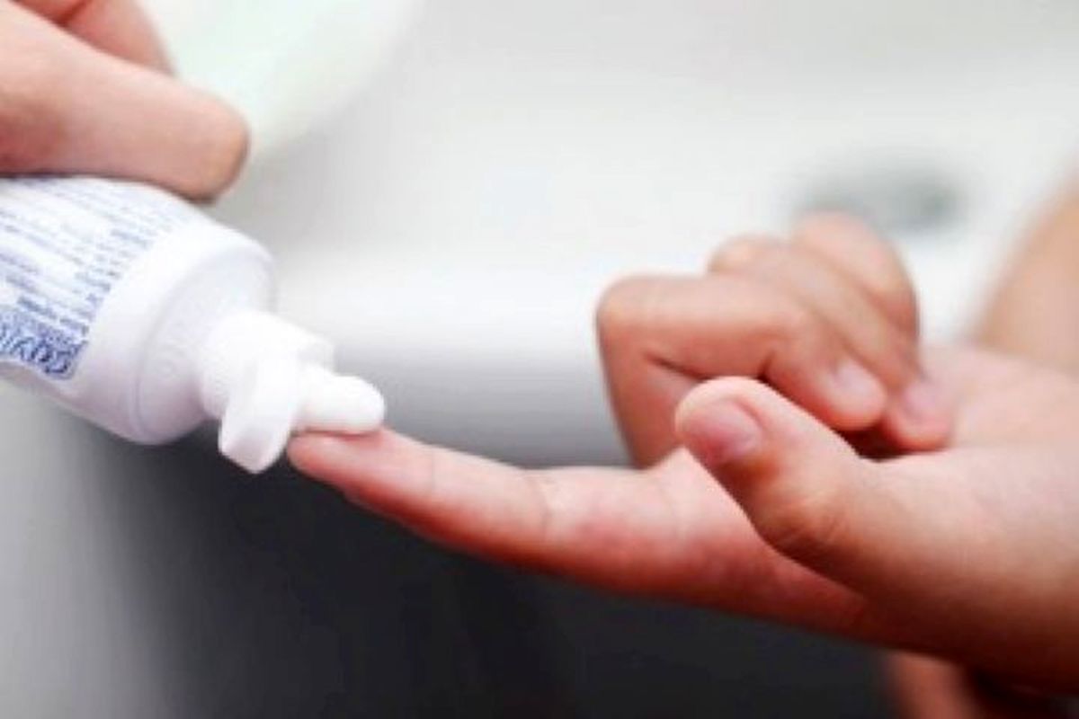 اثرات خمیردندان و سیب زمینی بر سوختگی