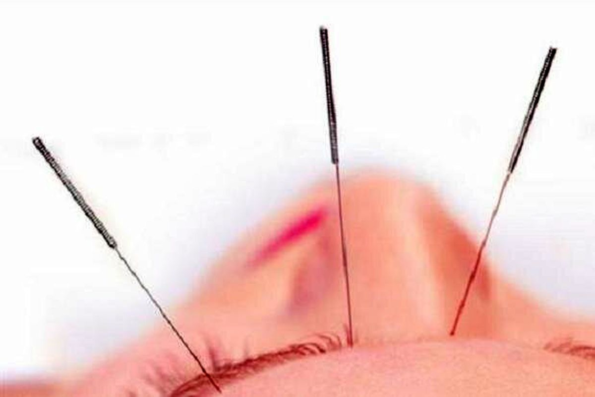 از طریق گوش خود وزن کم کنید!