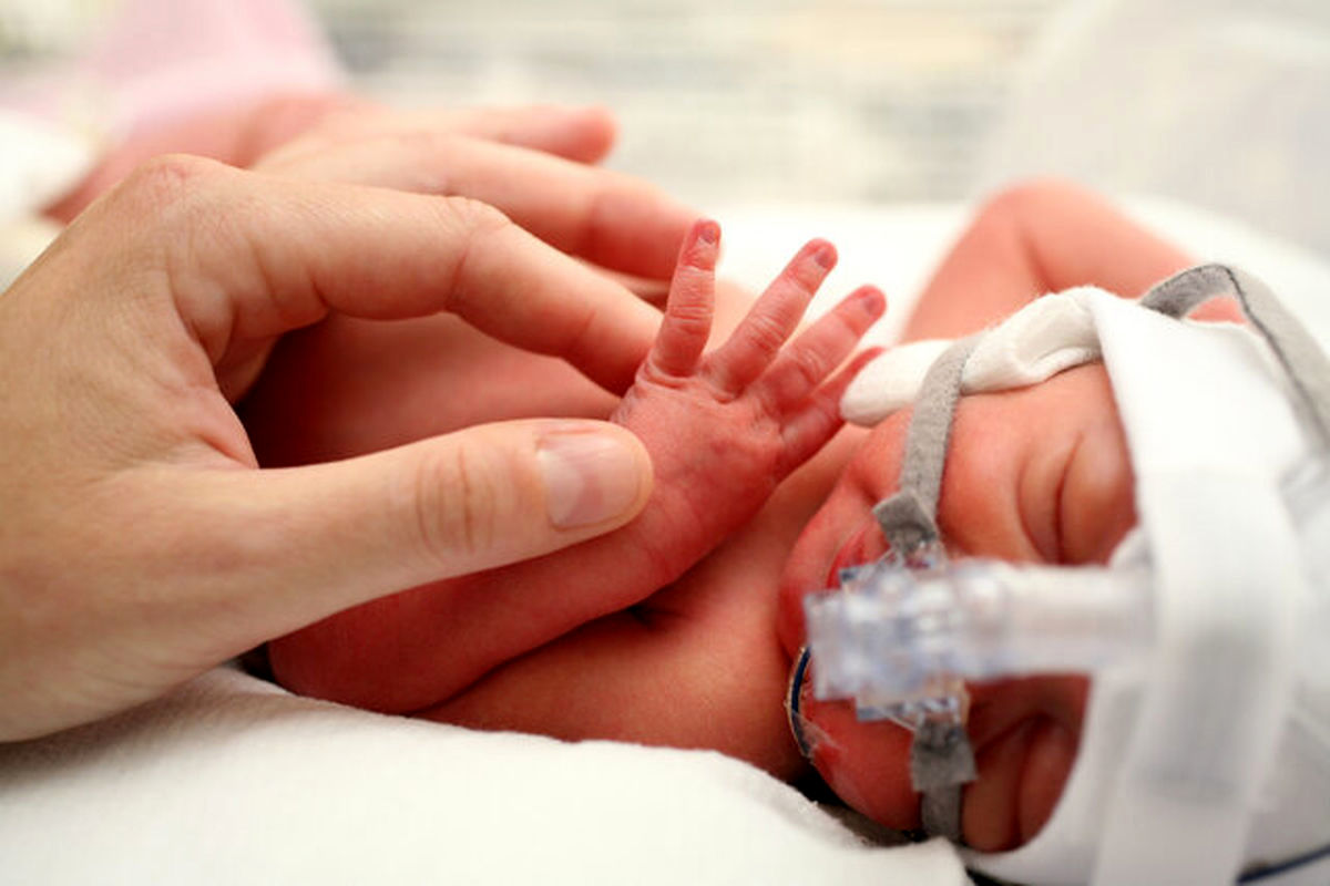 تولد نوزادی هم وزن یک سیب + عکس