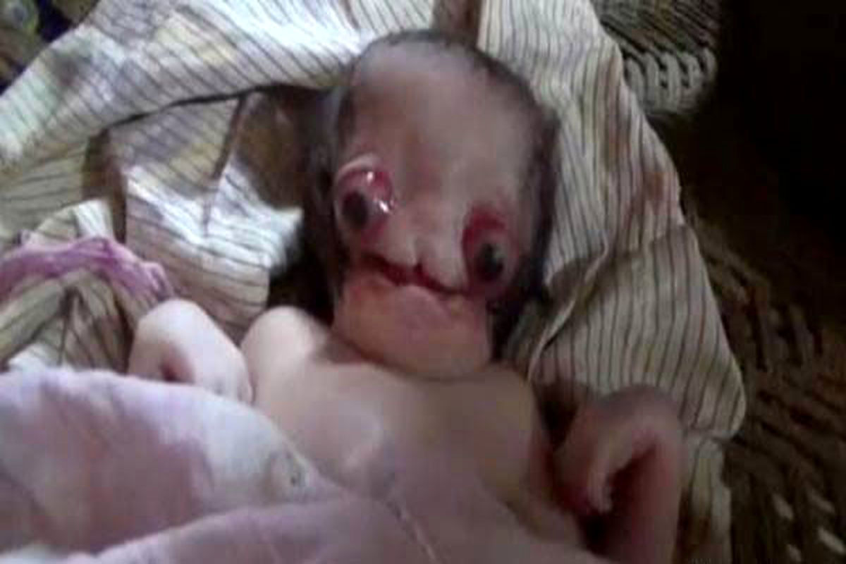 با دیدن این عکس شوکه می شوید / ترسناک ترین نوزاد به دنیا آمد!