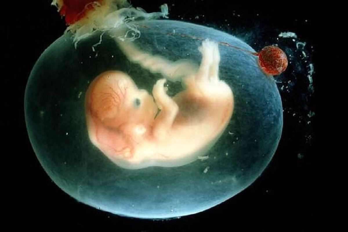 شرایط سقط جنین قانونی اعلام شد