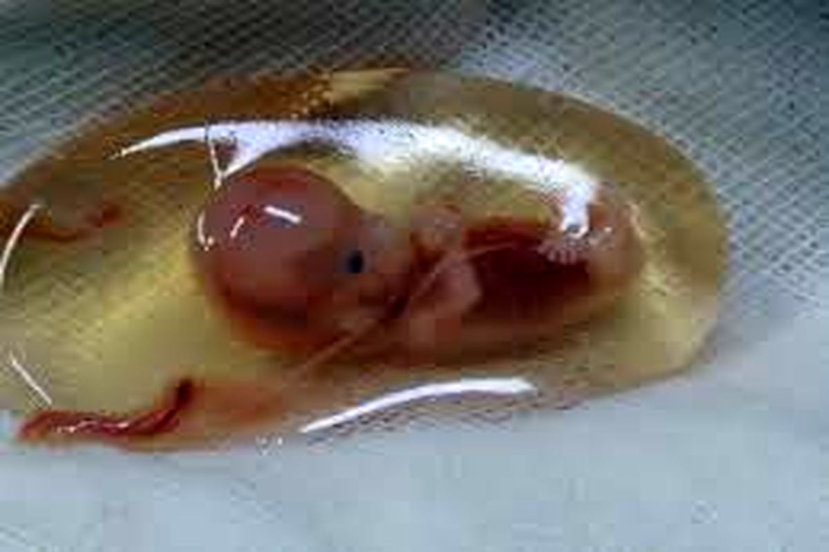 دستورالعمل سقط جنین تغییر کرد