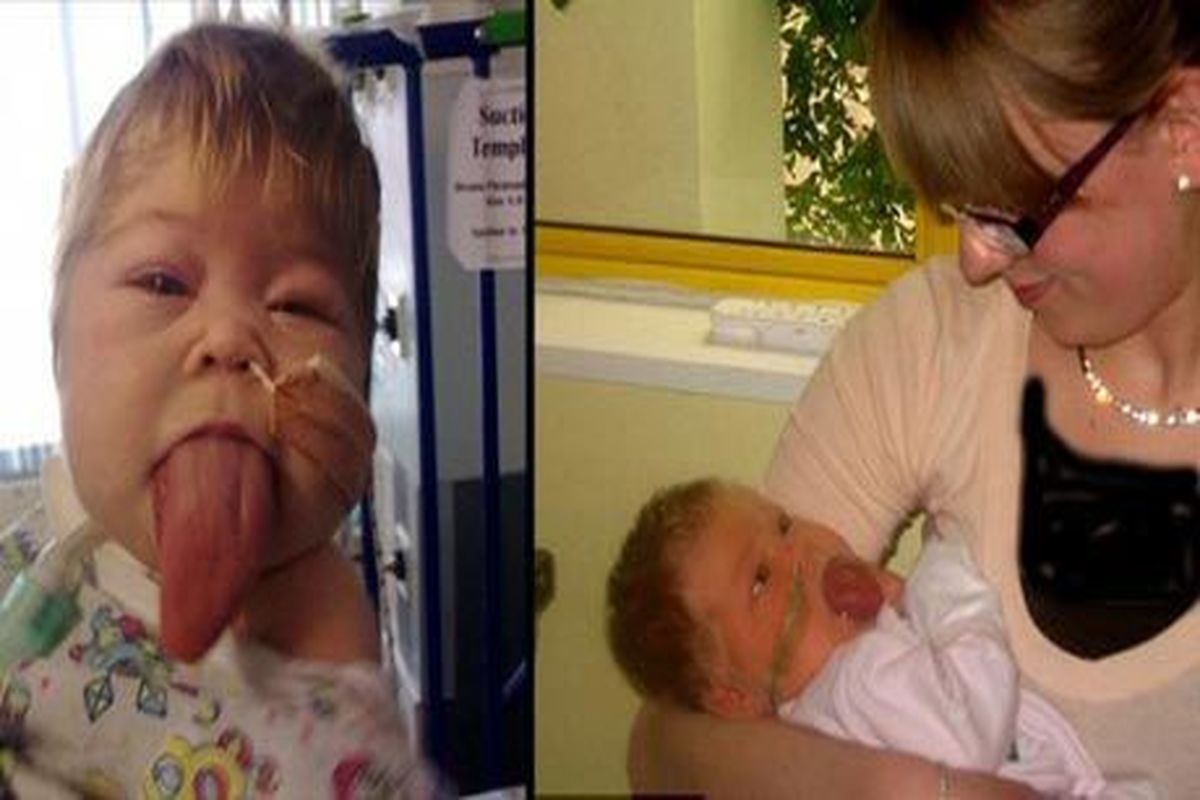 تولد یک نوزاد عجیب الخلقه + عکس