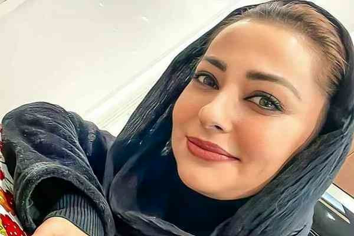 جراحی پلک ، چهره نفیسه روشن را دگرگون کرد