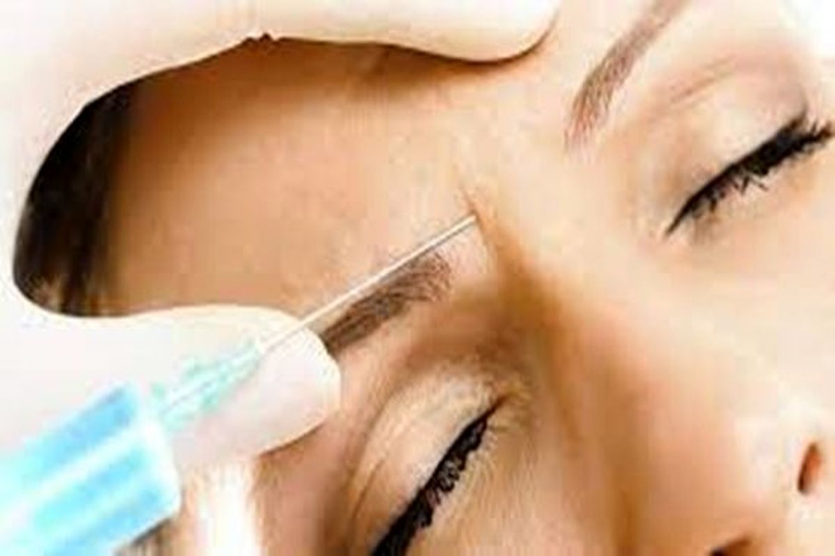 بعد از تزریق ژل و فیلر این علایم را جدی بگیرید