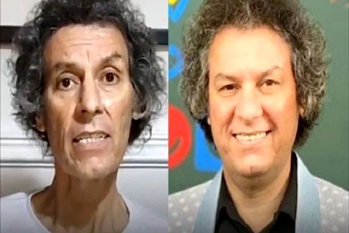 وخامت حال بازیگر معروف / سرطان چهره او را عوض کرد