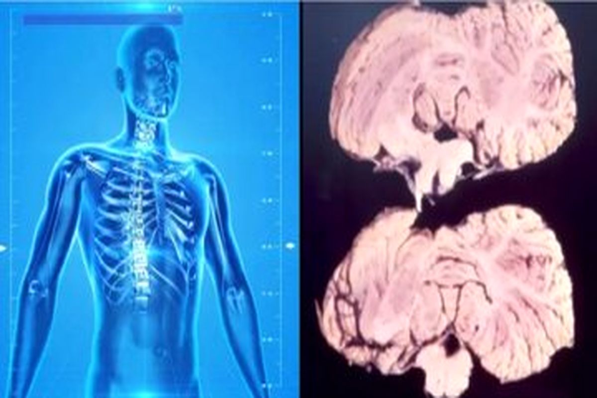 این بیماری صد درجه بدتر از کروناست