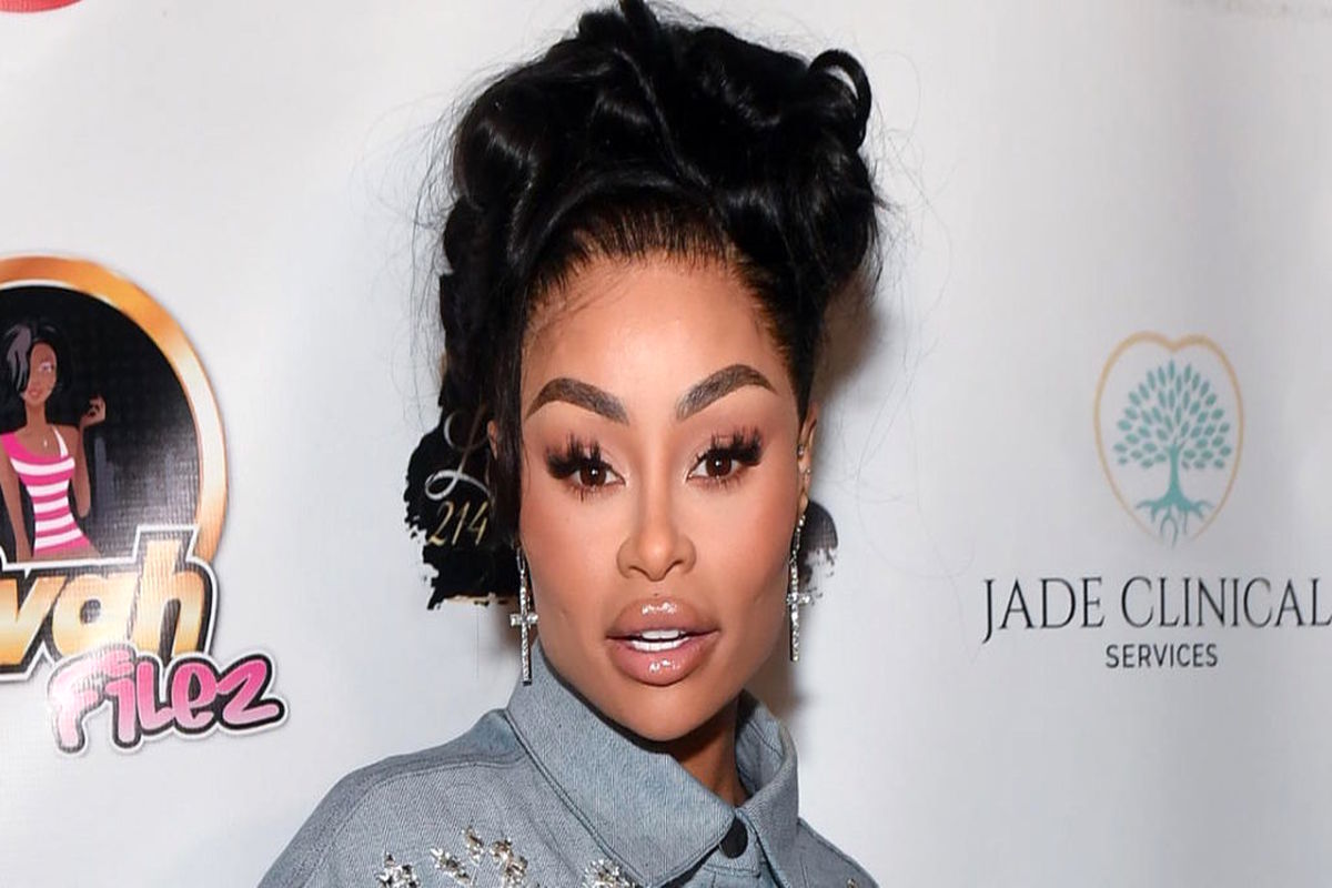 تمایل سلبریتی ها به تخلیه فیلر