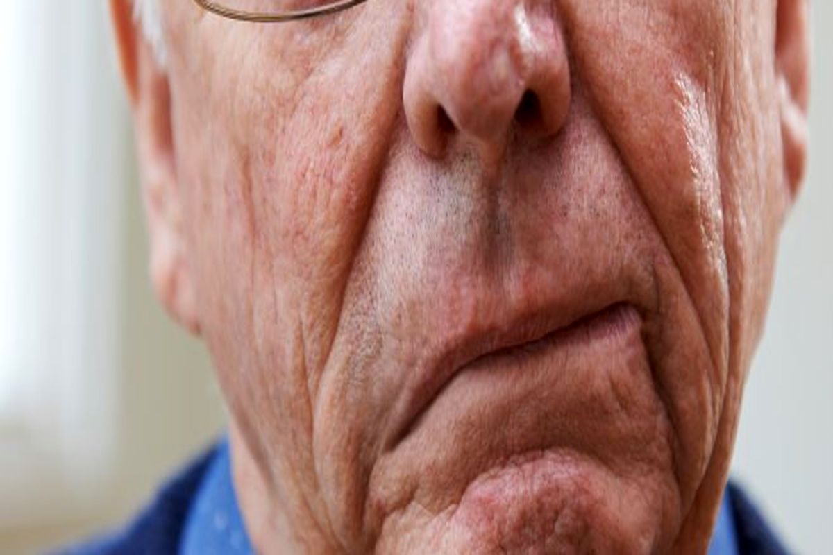 ۷ عاملی که باعث بروز سکته مغزی می‌شود