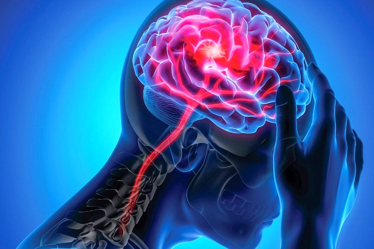 آمار عجیب افزایش سکته مغزی در آینده / اثر فزاینده این عارضه بر کشورهای فقیر