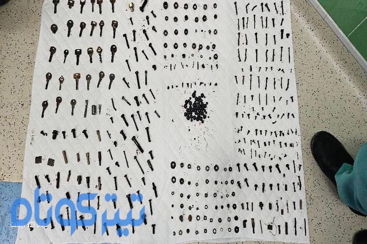 عجیب اما واقعی / بلعیدن بیش از ۲ کیلو اشیا فلزی توسط مرد اهوازی + عکس و فیلم